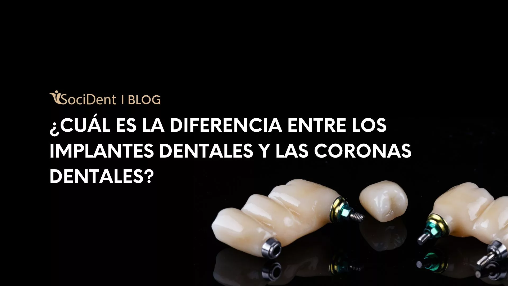 Diferencia entre coronas dentales y implantes dentales
